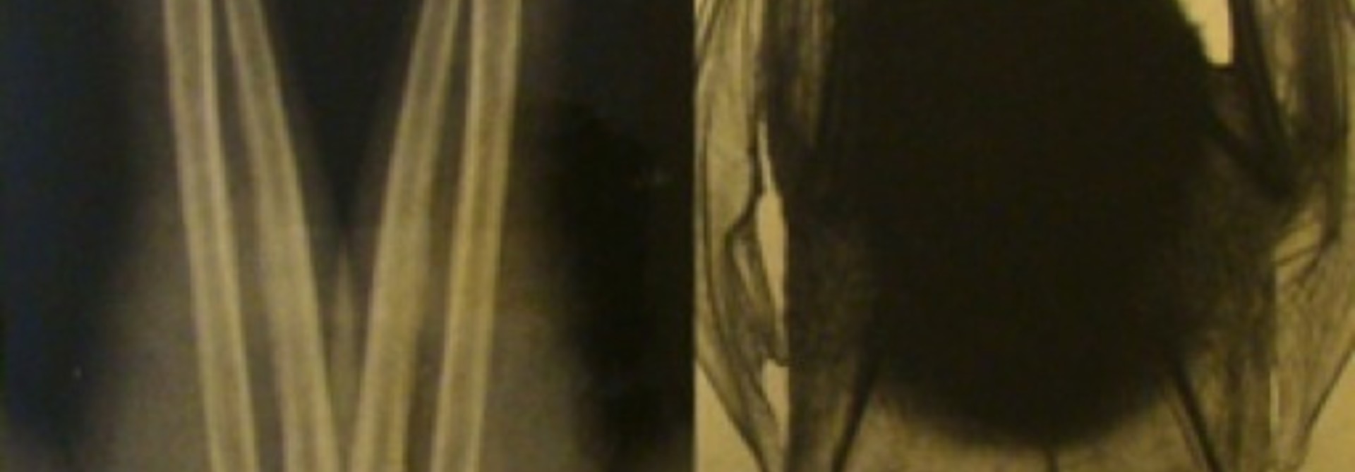 Natural Affinities I: Arm X Ray And Big Ear Bat