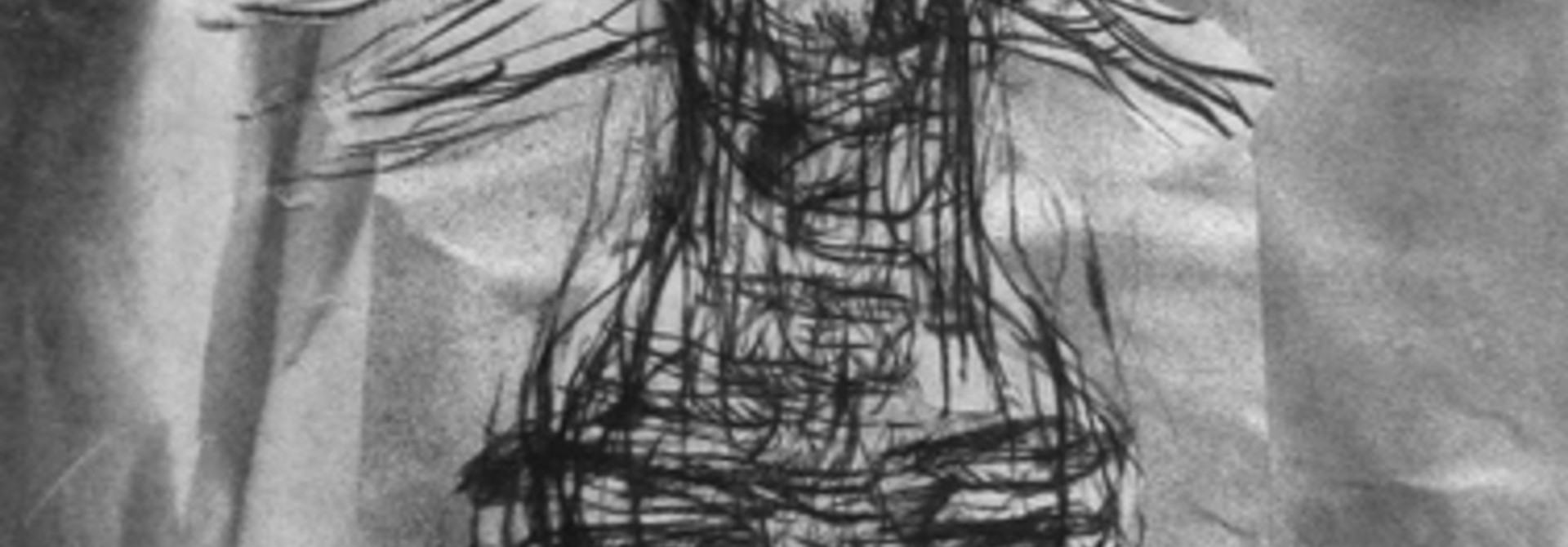 Irradiated Figure 2
