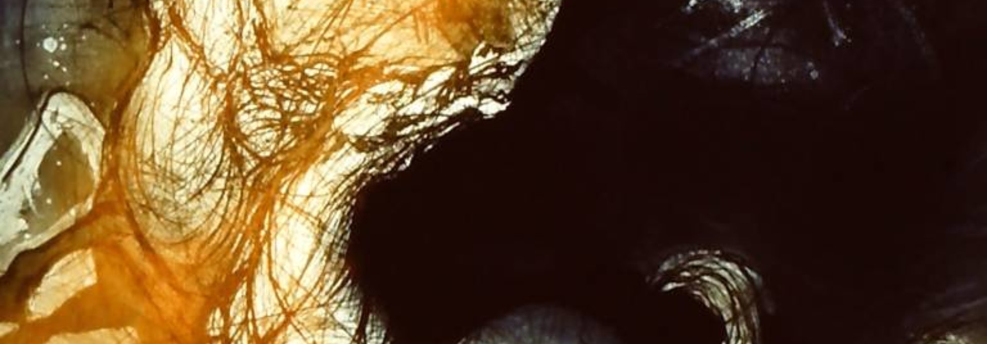 Restlessness