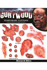 Wound Tattoo 'Burned Alive