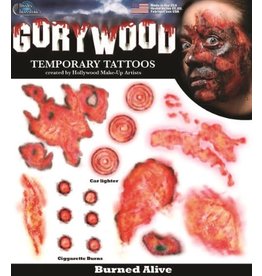 Wound Tattoo 'Burned Alive