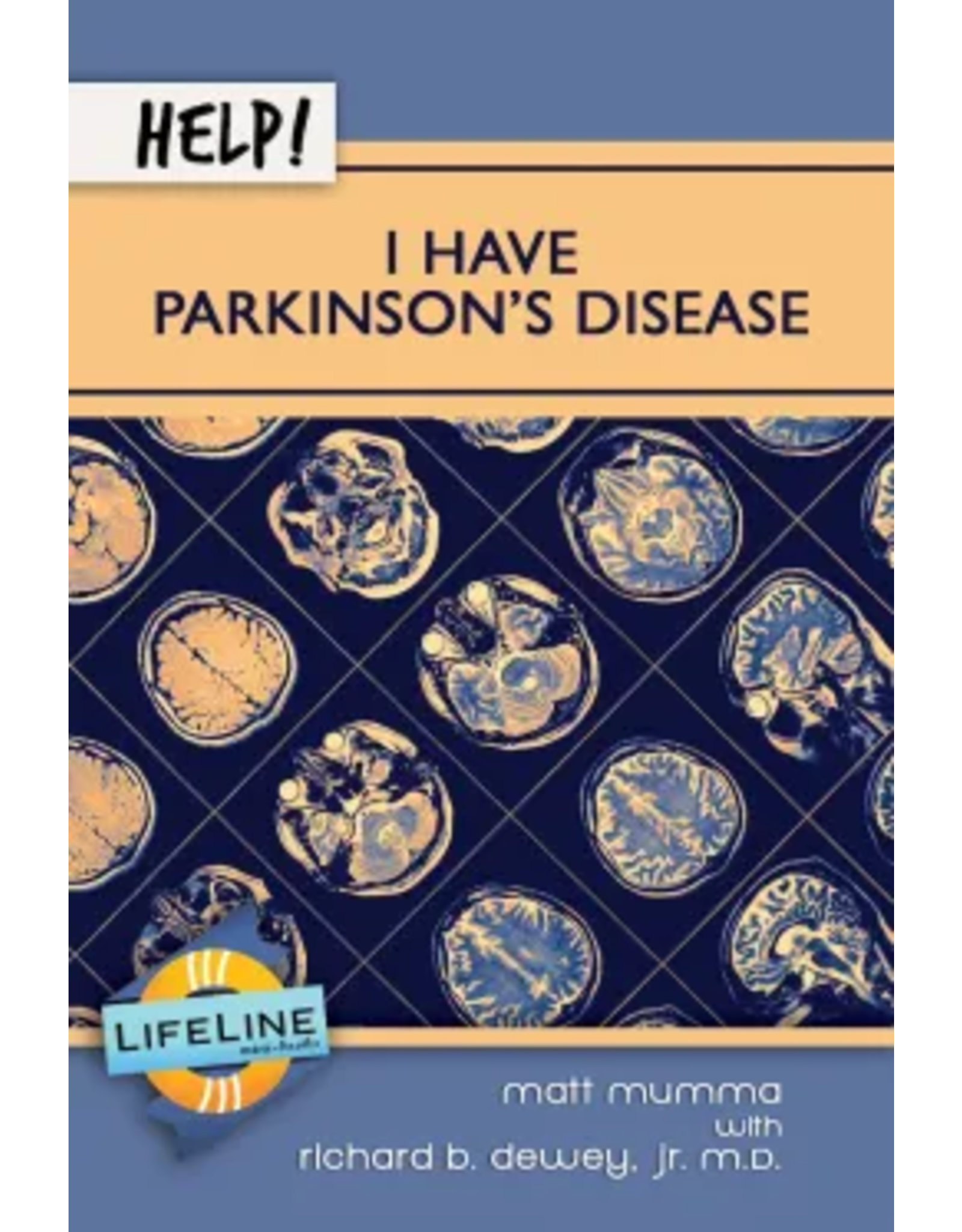 Help! I Have Parkinson's disease