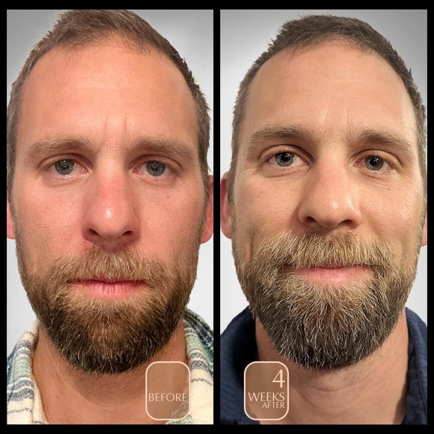 Botanical Peptide Repair Cream