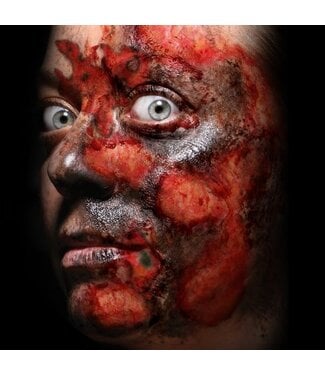 TINSLEY TRANSFERS TRAUMA TAT BURNED ALIVE