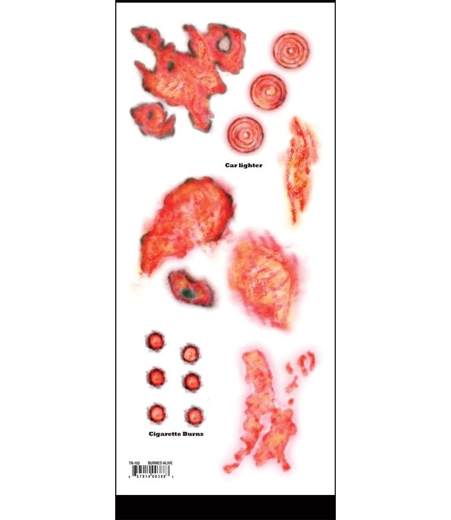 TINSLEY TRANSFERS TRAUMA TAT BURNED ALIVE