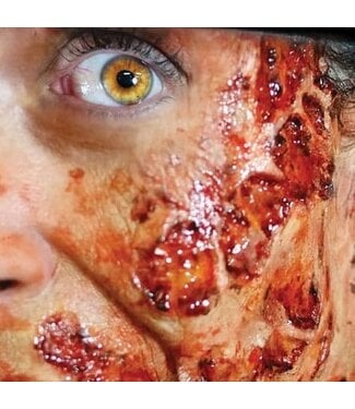 TINSLEY TRANSFERS FX TRANSFERS BURNED FLESH