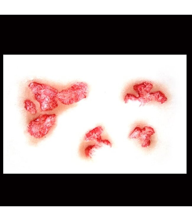 TINSLEY TRANSFERS FX TRANSFERS BURNED FLESH