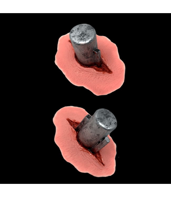 Tinsley 2CT Latex Blots