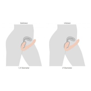 STRAP U STRAPLESS STRAP ON ERGO W/REMOTE LIGHT