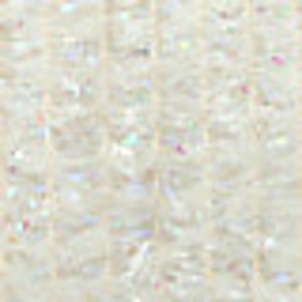 Wapsi Variegated Tinsel Chenille Med