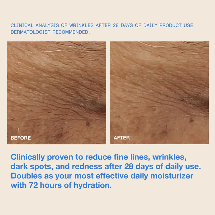 DUNE SUNCARE THE MUG GAURD