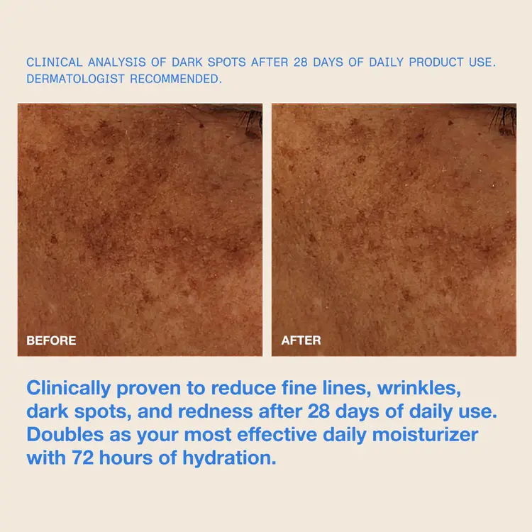 DUNE SUNCARE THE MUG GAURD