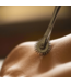 Wartenberg Pinwheels