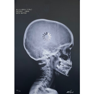 IMBUE SIGNED PRINT: DATA BUFFER PATIENT IMBUE (X-RAY) IMBUE SIGNED PRINT: DATA BUFFER PATIENT IMBUE (X-RAY)