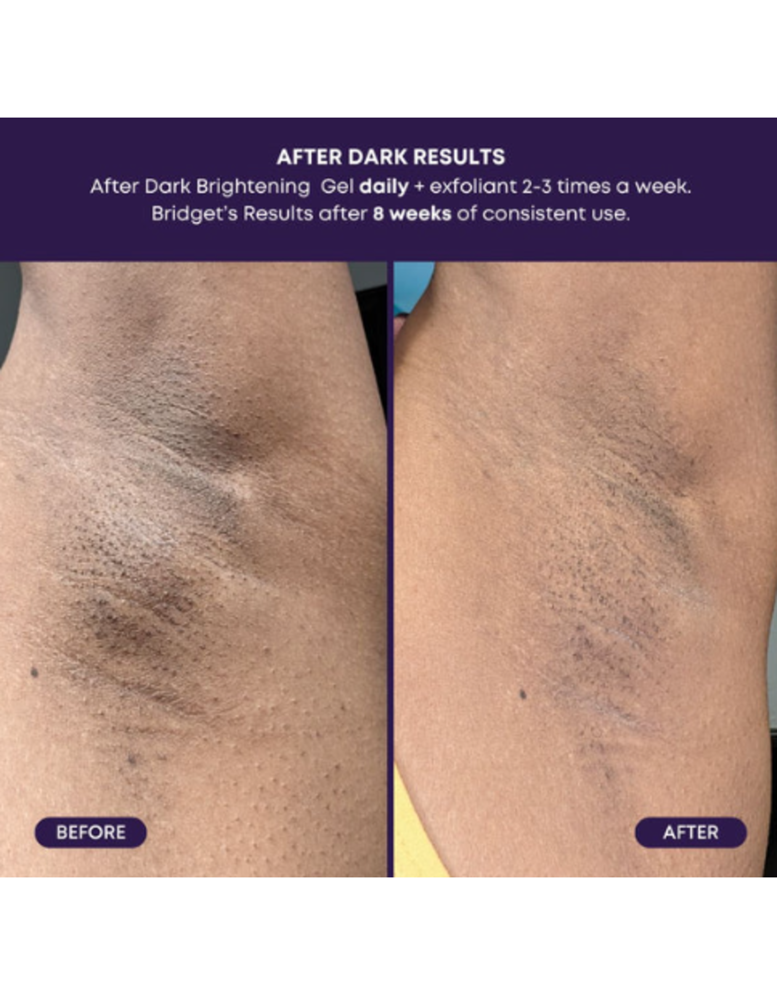 Bush Balm Bush Balm - After Dark Brightening Gel
