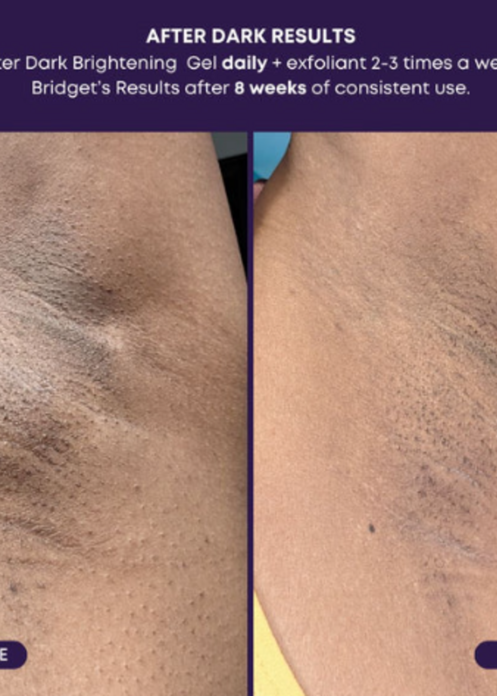 Bush Balm Bush Balm - After Dark Brightening Gel