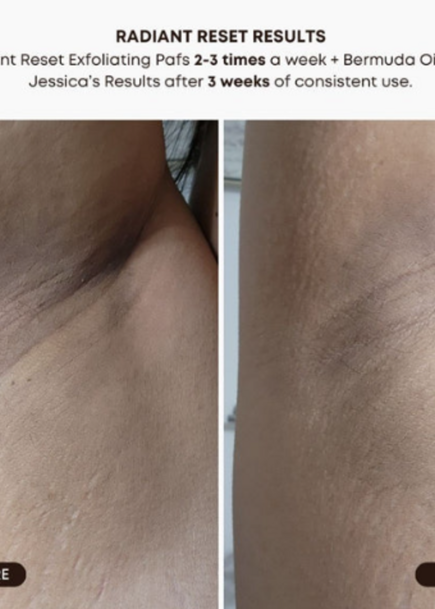Bush Balm Bush Balm - Radiant Reset Exfoliating Toner Pads