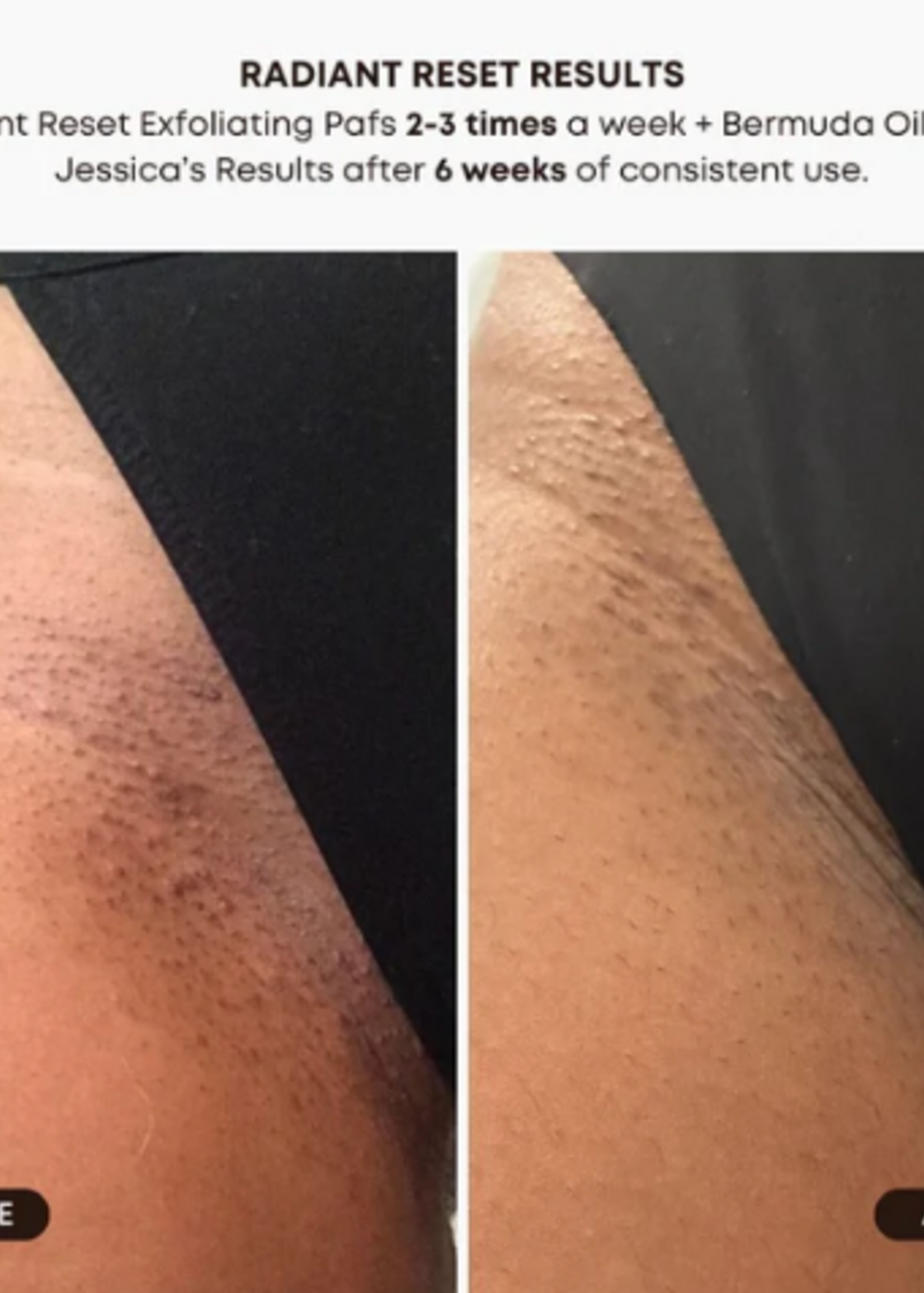 Bush Balm Bush Balm - Radiant Reset Exfoliating Toner Pads