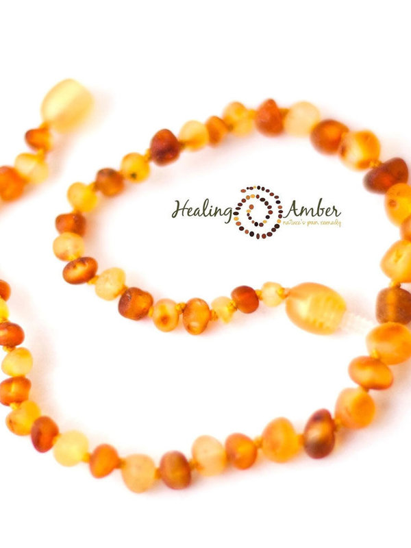 Healing Amber 11" Necklace