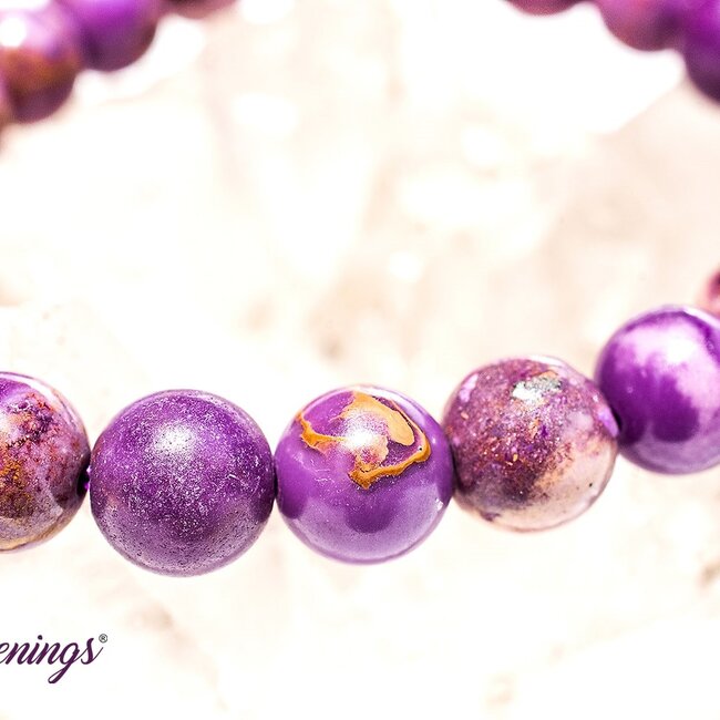 Phosphosiderite Bracelets - 8mm