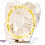 Yellow Gold Opal Bracelets - 4mm