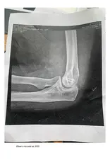 Objektiv Lucas Blalock: Why must the mounted messenger be mounted?