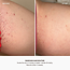 Nude Ingrown Hair 2 Step Routine