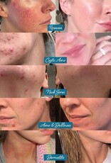 Darlin's Skincare Tallow Face Balm | Natural Blue Tansy Skincare Moisturizer