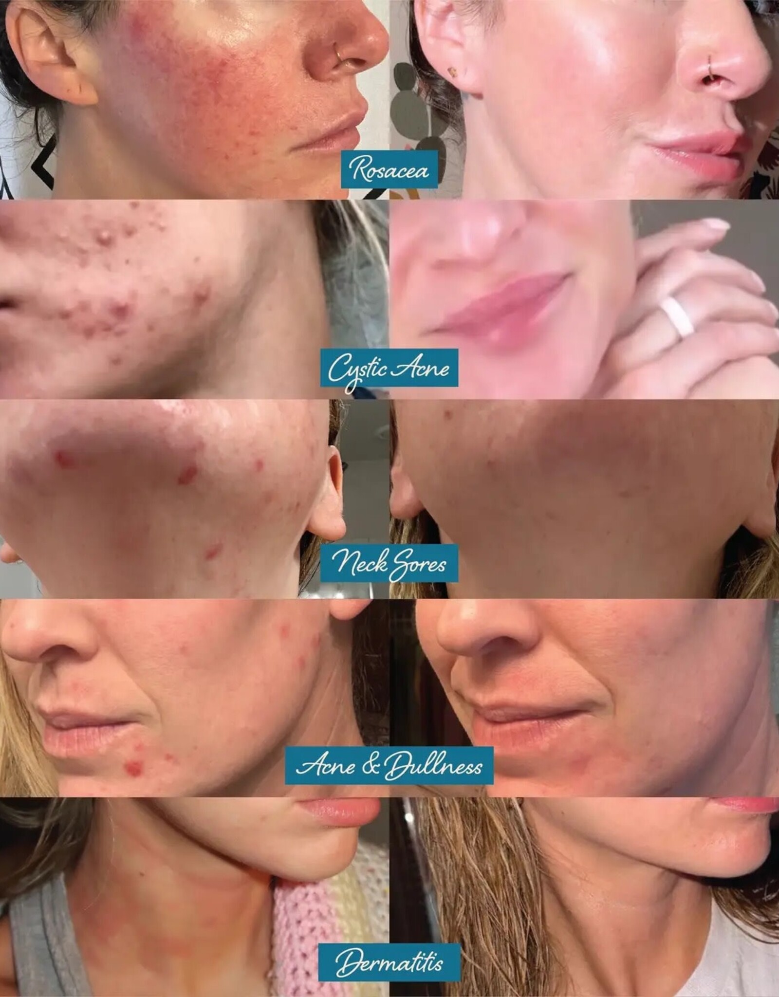 Darlin's Skincare Tallow Face Balm | Natural Blue Tansy Skincare Moisturizer