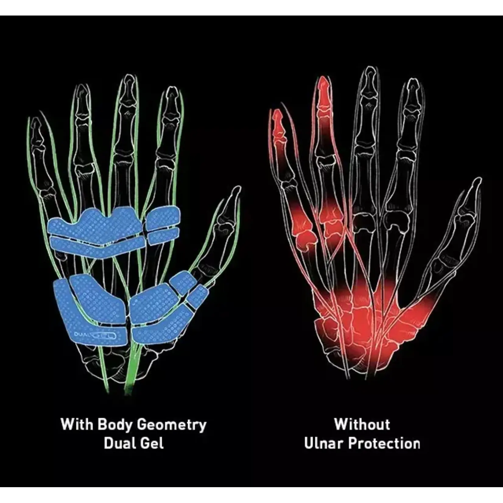 Specialized SPORT GEL SHORT FINGER GLOVES