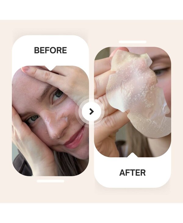 MaskerAid Spotted Pores - Hydrocolloid Nose Patches