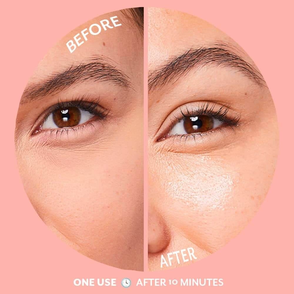 Patchology Served Chilled Bubbly Brightening Eye Gels, Single
