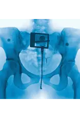 Lorde - Virgin (Exclusive Red Vinyl)