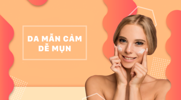 DA MẪN CẢM - DỄ MỤN