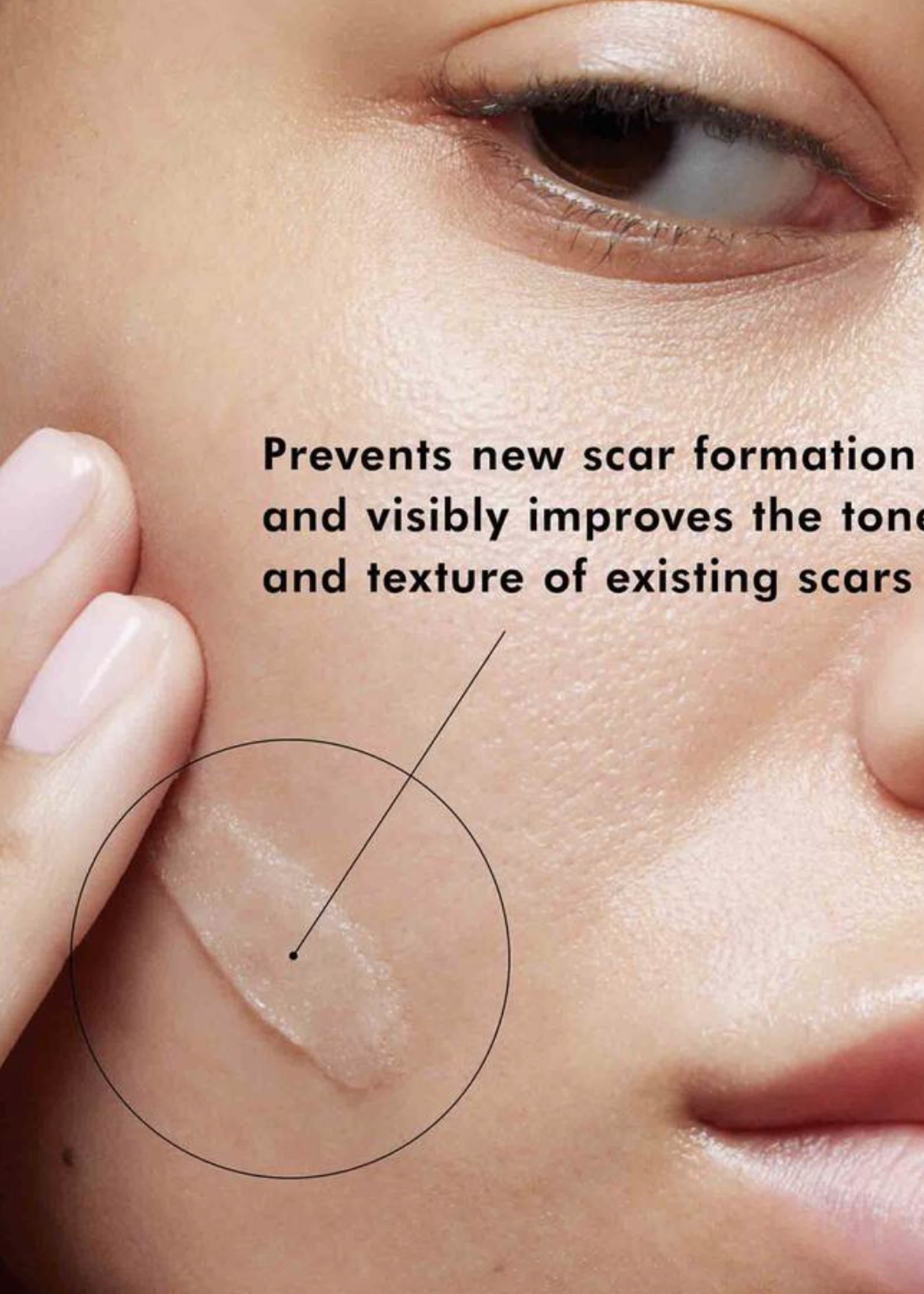 SkinCeuticals Advanced Scar Control