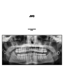 Rock/Pop Jack Van Cleaf - JVC (Blood Splatter Vinyl) (NM/NM)