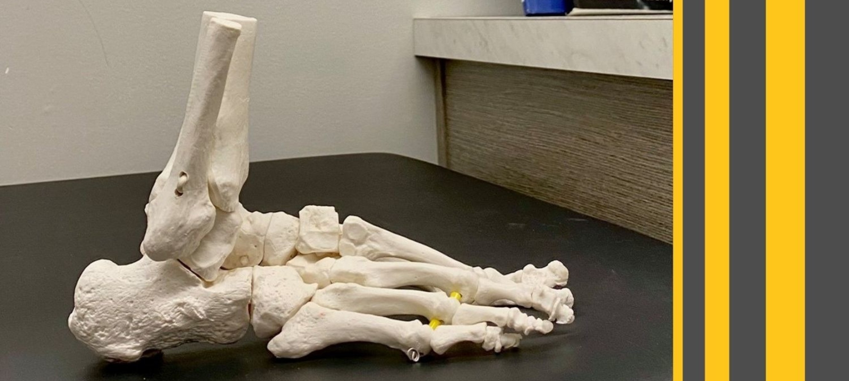 Treating Plantar Fasciitis