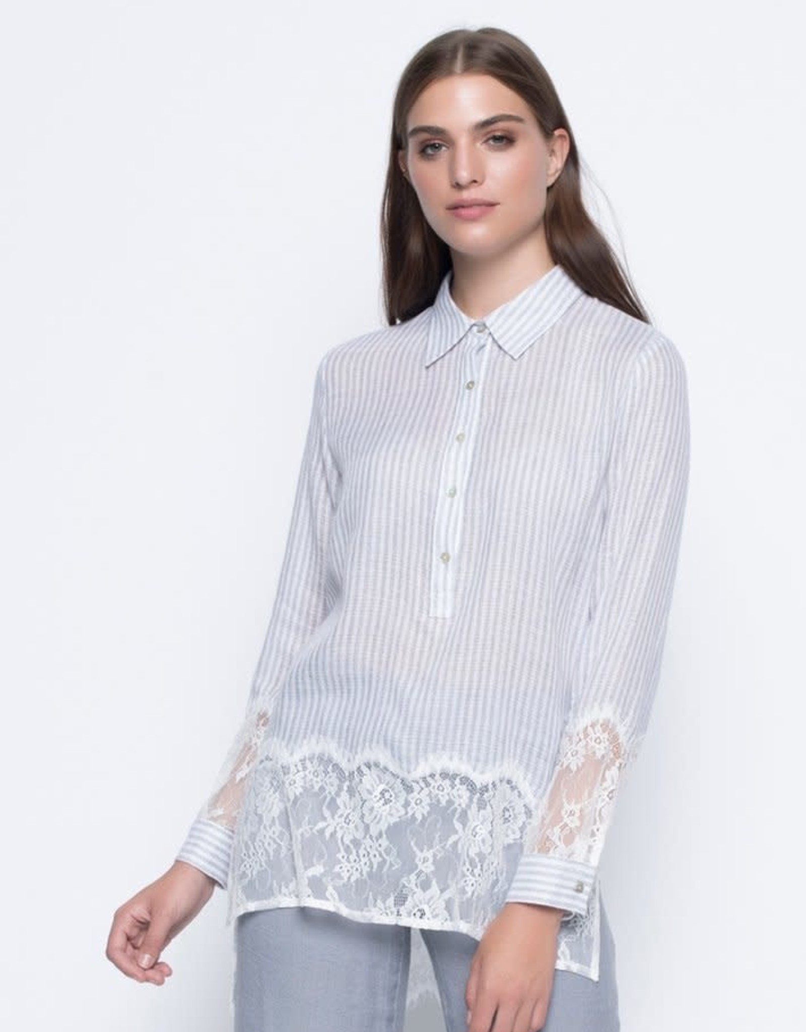 Lace Trimmed Placket Tunic