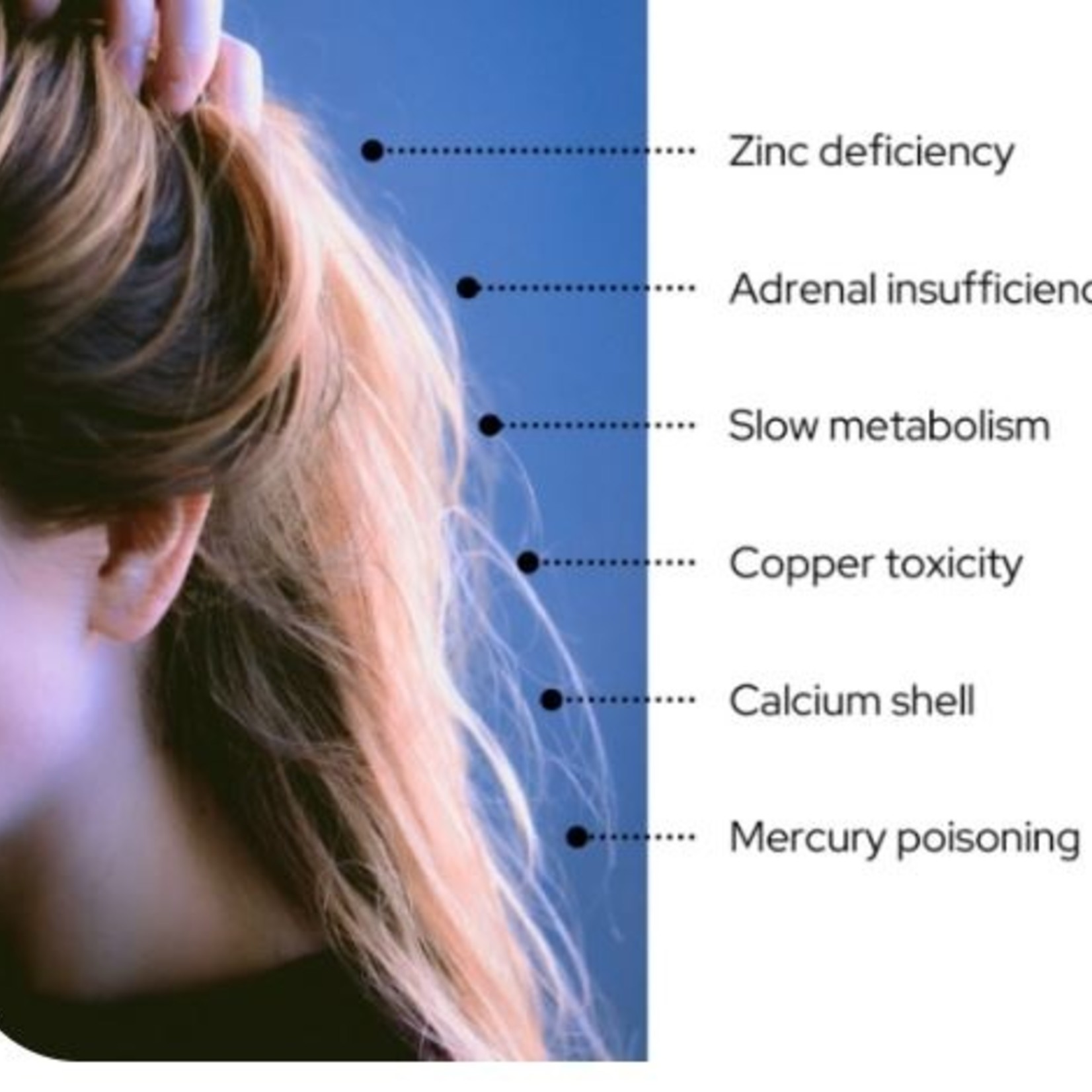 ARL Hair Tissue Mineral Analysis