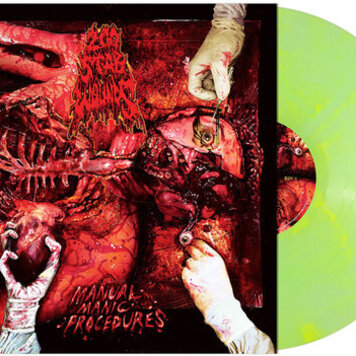 Pre-Order - 200 Stab Wounds - Manual Manic Procedures LP