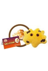 Gallstone