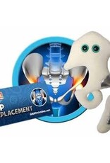 Hip Replacement