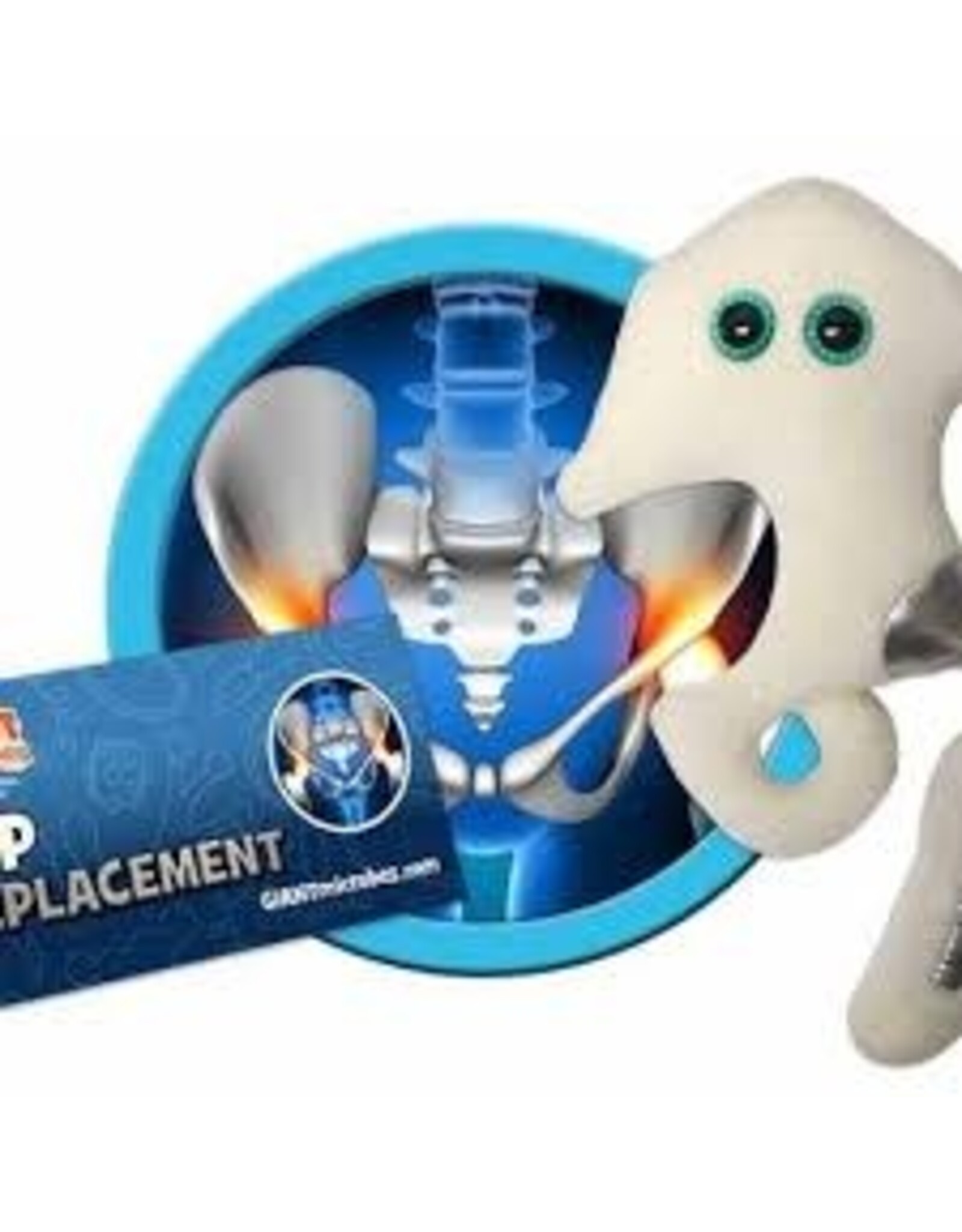 Hip Replacement