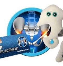 Hip Replacement