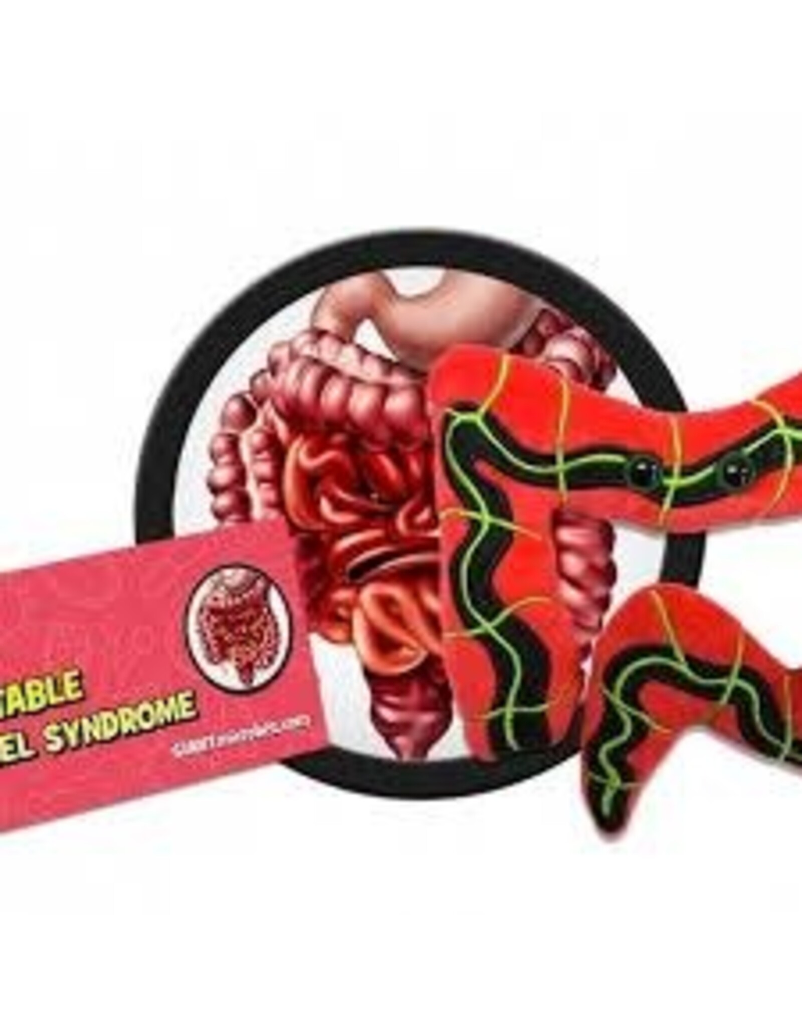Irritable Bowel Syndrome
