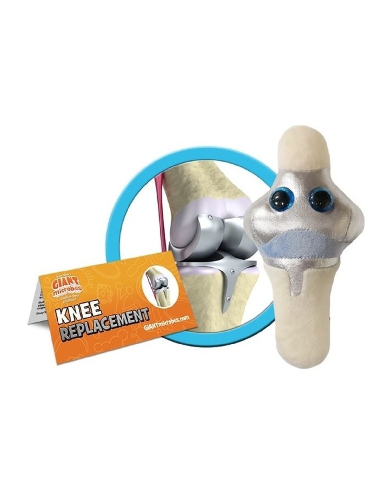 Knee Replacement