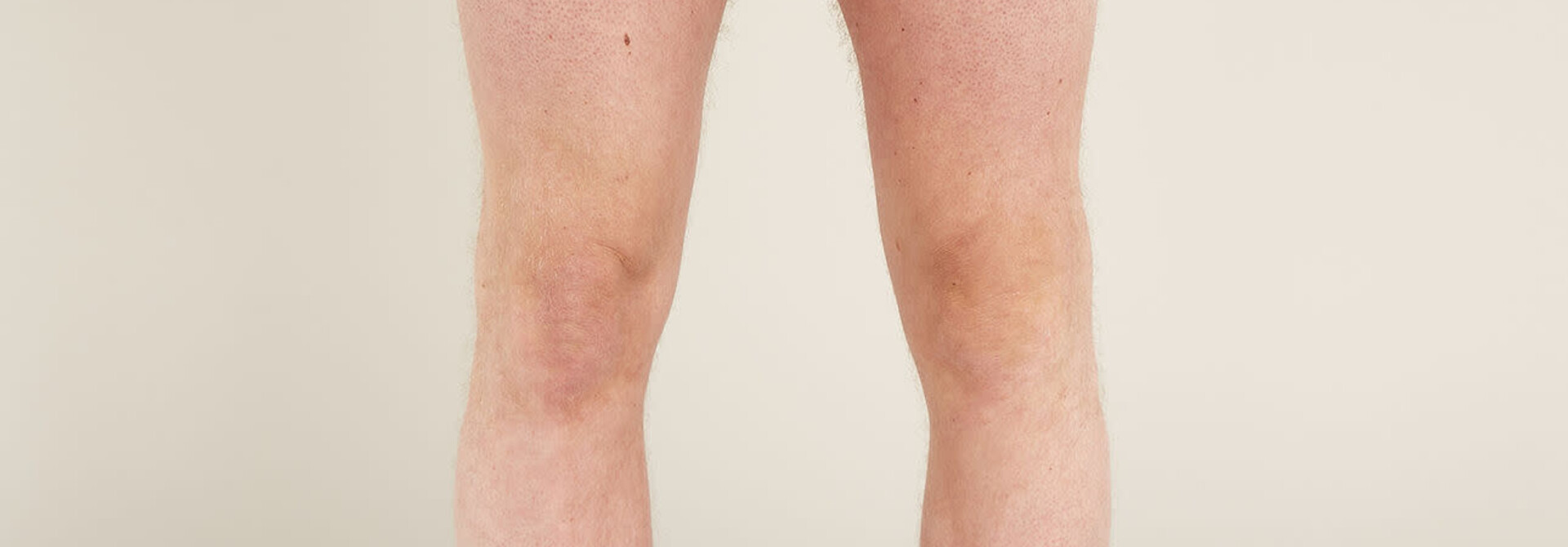 Men's Merino 150 Anatomica Boxers