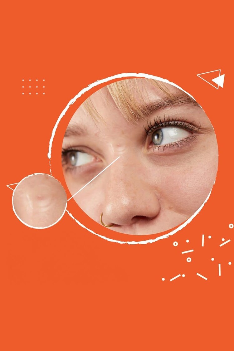 Patchology Dot Dot Dash Hydrocolloid Acne Pimple Patches