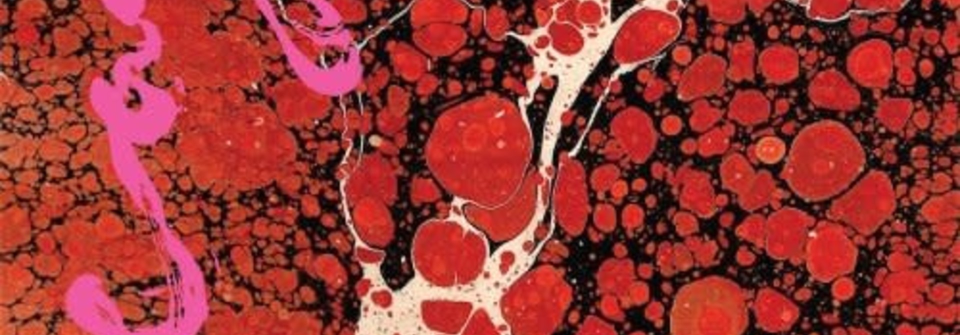 Iceage • Beyondless
