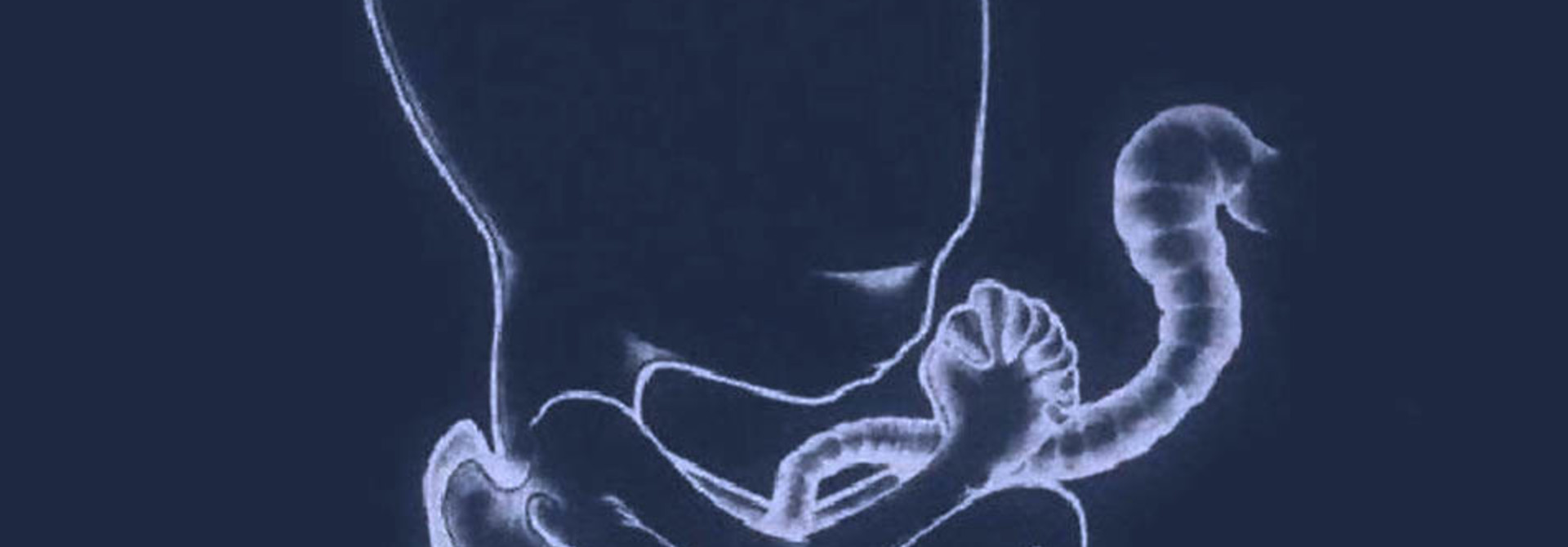 Sigur Rós • Ágætis Byrjun